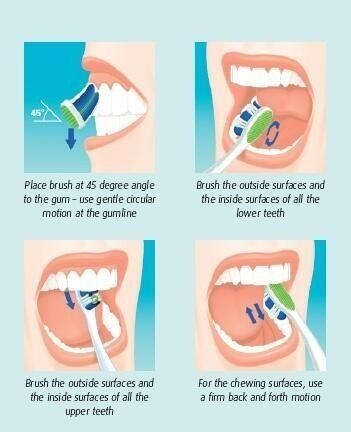 How to brush your teeth properly. Dental Posters, Dental Implants Cost, Dental Hygiene School, Dental Facts, Laser Teeth Whitening, Brush Your Teeth, Best Teeth Whitening, Oral Health Care, Teeth Care