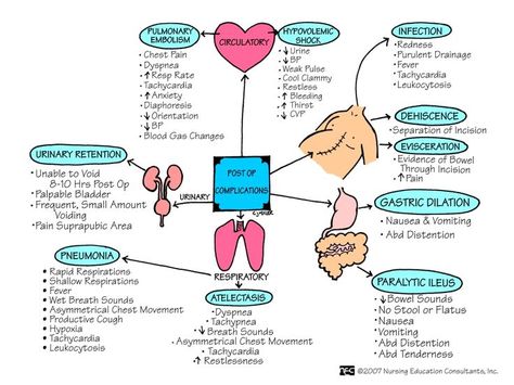 Do you plan on going to PACU when you're out of nursing school? This offers up a great visual on the responsibilities you may face being a PACU nurse.  Follow @nurselinds for more great tips and tools!  Thanks work.chron.com for original post. Pacu Nurse, Perioperative Nursing, Nursing Information, Nursing Fun, Nursing Board, Med Surg Nursing, John Russell, Nursing Mnemonics, Surgical Nursing