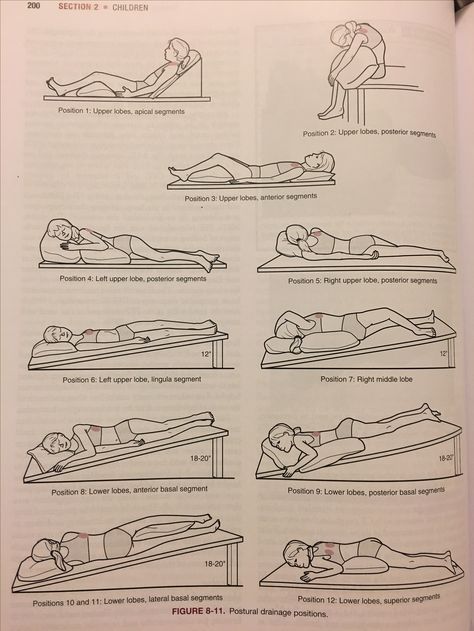 Postural drainage positions Postural Drainage, Pt Student, Fluid In Lungs, Medical Learning, Nurse Skills, Pt School, Belly Pooch Workout, Pooch Workout, Physical Therapy Student