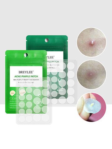 Спонж Beauty Blender, Pimple Remover Tool, Pimple Remover, Tea Tree For Acne, Koleksi Makeup, Acne Pimple Patch, Mask Skin, Alat Makeup, Pimple Patch