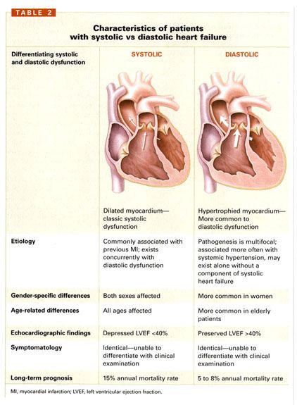 Cardiovascular System, Ribbon Slides, Ribbon