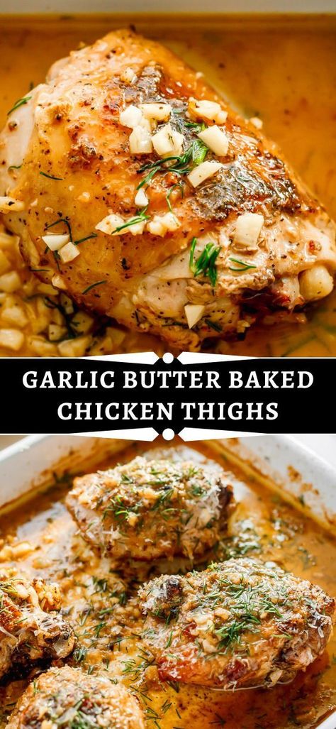 Easy Chicken Thigh Recipes Baked, Baked Butter Chicken, Garlic Butter Baked Chicken, Butter Baked Chicken, Baked Garlic Chicken, Chicken Thighs Baked, Chicken Thighs In Oven, Easy Baked Chicken Thighs, Chicken Thights Recipes