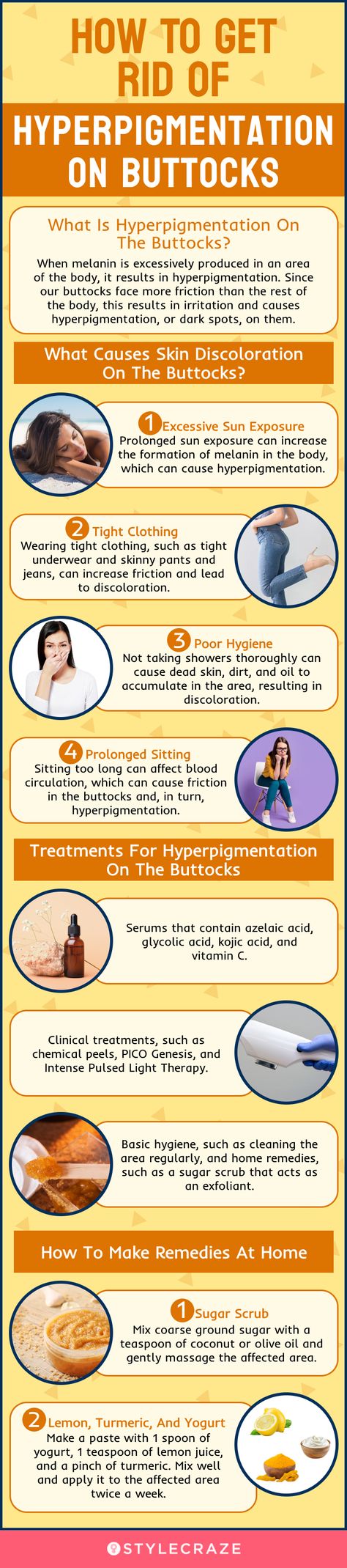 Hyperpigmentation On Buttocks: Causes, Tips, And Treatments Hyperpigmentation On Buttocks, Clearing Hyperpigmentation, Hyperpigmentation Remedies, Female Hygiene, Treating Hyperpigmentation, Hygiene Tips, Black Skin Care, Free Advice, Makeup Makeover