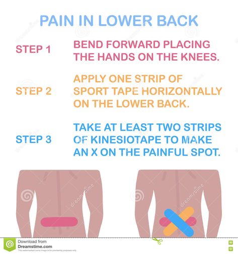 Physio Tape, Hip Flexor Pain, Severe Lower Back Pain, K Tape, Kt Tape, Causes Of Back Pain, Pain Relief Remedies, Ligament Tear, Kinesio Taping