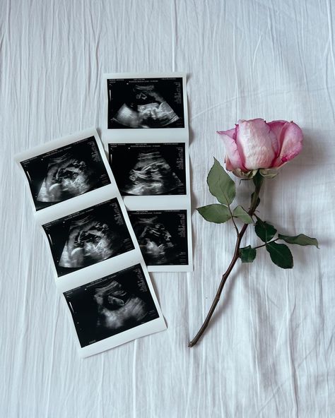 Positive Pregnancy Test Pictures, Second Baby Announcement, Ultrasound Reveal, Baby Ultrasound Pictures, Ultrasound Announcement, Simple Pregnancy Announcement, Pregnancy Announcement Pictures, Pregnancy Announcement Family, Twin Pregnancy Announcement