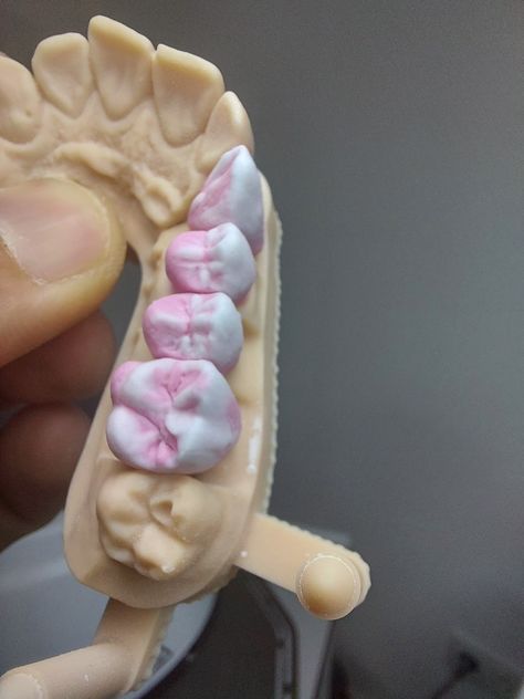 Exocad Dental Design, Dental Photography, Dentistry Student, Dental Anatomy, Aesthetic Dentistry, Dental Technician, Dental Life, Dental Laboratory, Dental Art