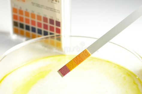 Ph indicator. Ph-indicator strips on clean background , #AFF, #indicator, #Ph, #strips, #background, #clean #ad Ph Indicator, Clean Background, Simple Business Cards, Free Stock Photos, Business Card, Photo Image, Royalty Free Stock Photos, Stock Photos, Health