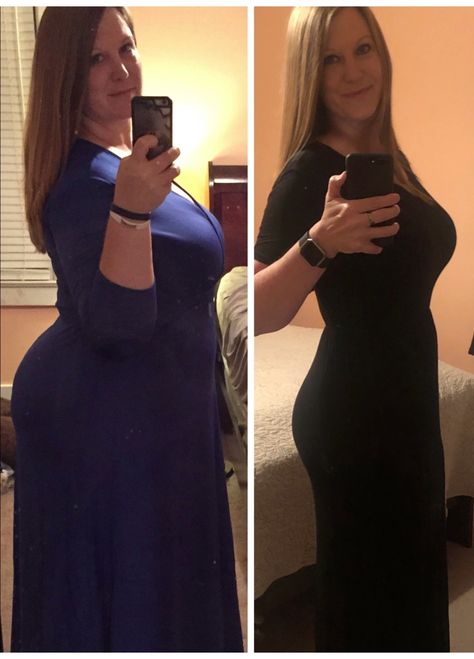 keto diet before and after Carnivore Before And After Women, Carnivore Before And After, Carnivore Diet Before And After Women, Diet Results, Meat Diet, Carnivore Diet, My Mood, Carb Diet, Fitness Blog