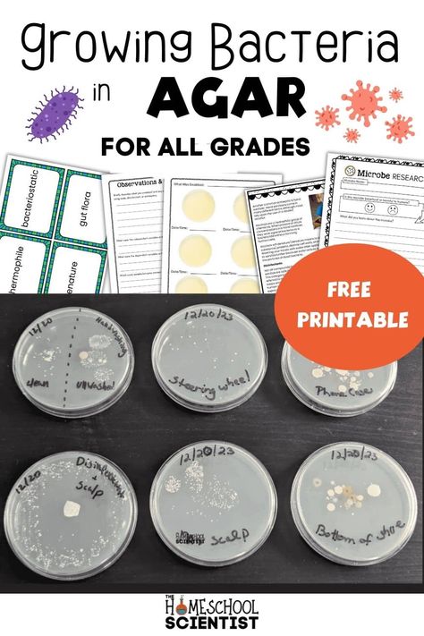 Growing bacteria in agar is a fascinating human body activity and immune system lesson. Use the free science printable for elementary, middle, and high school. Request our special high school insert too. Science Fair Questions, Immune System Activities, Biology Activity, Human Body Activities, Biology Science, Problem Statement, Petri Dishes, Gut Flora, Petri Dish