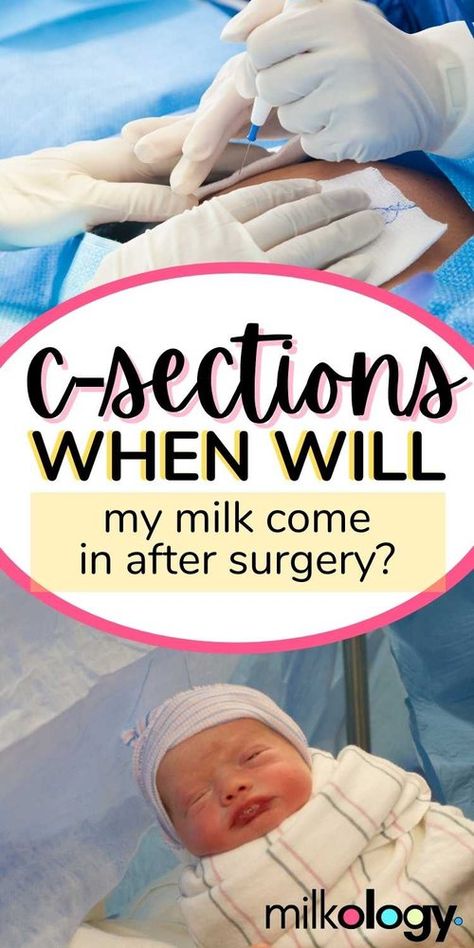 When Will My Milk Come In After C-Section Surgery? — Milkology® When Does Breastmilk Come In, When Does Milk Come In After Birth, Dry Up Breastmilk, When To Start Pumping, Exclusively Breastfeeding, Breastfeeding After C Section, Milk Booster, Extended Breastfeeding, Increase Breastmilk