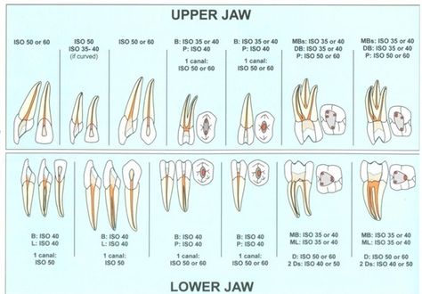 Dentaltown - Endo Access Pic Database? Dental Charting, Dental Medicine, Dental Assistant Study, Dental Posters, Dentistry Student, Dental Anatomy, Restorative Dentistry, Dental Art, Dental Student