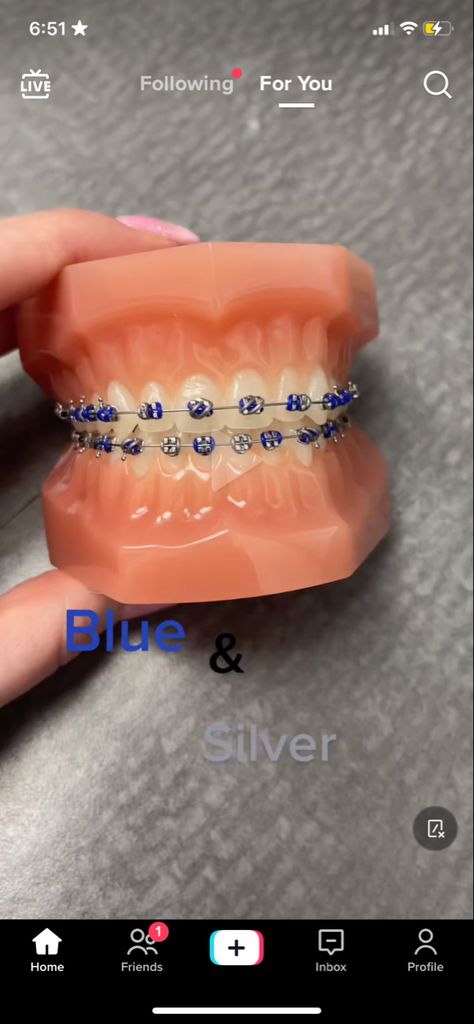 Navy Blue Braces Teeth, Braces Navy Blue, Dark Blue Braces, Navy Blue Braces, Braces Colours, Blue Braces, Braces Ideas, Silver Braces, Braces Bands