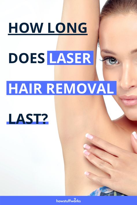 Whether you wax, shave, or use Nair, you've probably thought about researching a longer term solution. Read on to find out if permanent laser hair removal is really permanent. Laser Hair Removal After Care, Full Body Laser Hair Removal, Laser Hair Remover, Lazer Hair Removal, Laser Hair Removal Facts, Natural Hair Removal Remedies, Best Permanent Hair Removal, Permanent Laser Hair Removal, Hair Removal Diy