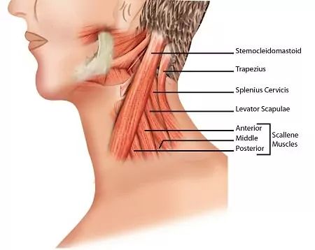 Wry Neck (Torticollis) | Causes and Symptoms | SportNova UK Pinched Nerve In Neck, Neck Muscle Pain, Sternocleidomastoid Muscle, Deep Brain Stimulation, Pinched Nerve, Peripheral Nerve, Brain Stimulation, Muscle Weakness, Muscle Strain