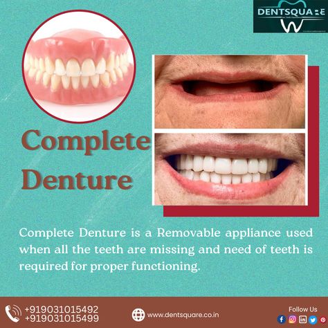 Complete Denture Before And After, Complete Denture, Lingual Braces, Dental Fun, Social Media Advertising Design, The Teeth, Book Your Appointment, Dental Clinic, Advertising Design