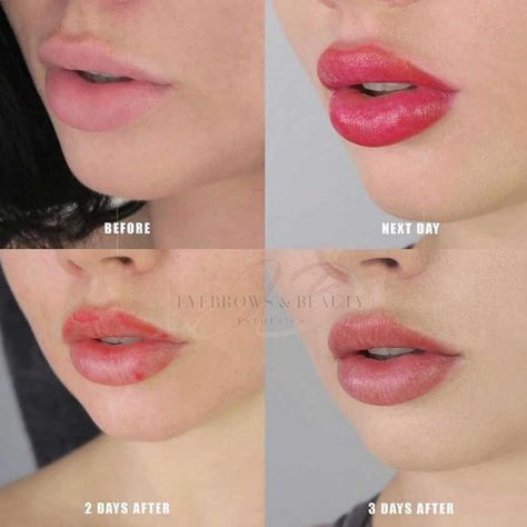 Read our list of factors that determine how long do lip tattoos last and learn how to prolong the results. #liptattoo #lipblush #permanentlipstick #liptattoolongevity #tattooedlips #liptint #permanentlips #pmuhub Cosmetic Lip Tattoo, Lip Color Tattoo, Lip Permanent Makeup, Lip Blushing, Lipstick Tattoos, Permanente Make-up, Botox Lips, Permanent Lipstick, Kylie Jenner Lips