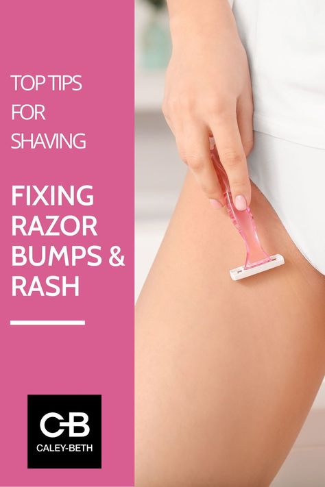 Summer is fast approaching and so is bikini season. It's a great time to stay smooth and healthy, so you can feel confident in your bikinis, swimsuits, and shorts. We have gathered our top tips on avoiding shaving irritation. Womens Shaving Tips Bikinis, How To Avoid Itchiness After Shaving, Avoid Razor Bumps Shaving, Best Womens Razor, Shaving Bumps, Shaving Tips, Razor Bumps, Skin Redness, Diy Scrub