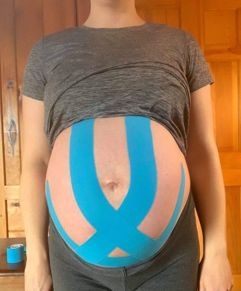 10 Ways to Use Kinesiology Taping for Pregnancy - Prokit Taping Belly While Pregnant, Tape For Pregnant Belly, How To Tape Pregnant Belly, K Tape For Pregnancy, Kinesio Tape Pregnancy, K Tape Pregnancy, Pregnancy Belly Taping, Belly Taping For Pregnancy, Kt Tape For Pregnant Belly