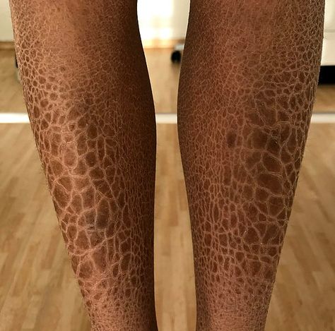 Holes In Skin Phobia, Trypophobia Skin, Ichthyosis Vulgaris, Scale Skin, Skin Drawing, Pattern Photography, Womens Health Care, Scaly Skin, Theatrical Makeup