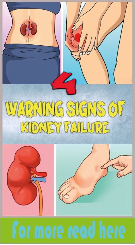 5 warning signs of kidney stones that we should remember Kidney Symptoms, Womens Health Care, Women Health Care, Kidney Health, Thigh Fat, Health Planner, Natural Health Tips, Back Pain Exercises, Health And Fitness Tips