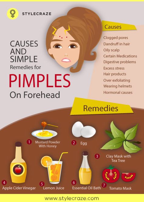 Why and simple solutions for acne on the forhead! Digestive Problems Remedies, Forehead Acne Cause, Remedies For Pimples, Pimples On Forehead, Forehead Acne, Pimples Under The Skin, Pimples Remedies, Natural Acne Remedies, How To Get Rid Of Pimples