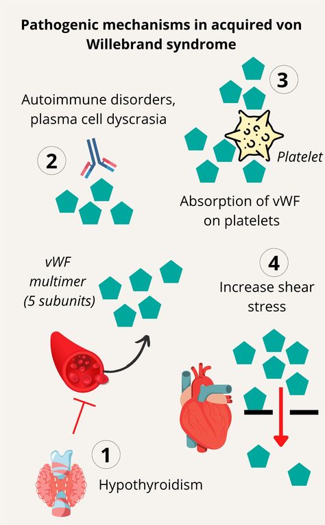 Acquired von Willebrand Syndrome - Pathophysiology • The Blood Project Von Willebrand Disease, Disease