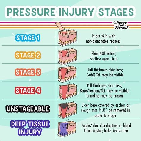 Pressure Injury, Nursing School Studying Cheat Sheets, Wound Care Nursing, Nursing School Life, Nursing School Inspiration, Nursing School Essential, Medical School Life, Nursing School Motivation, Nurse Study Notes