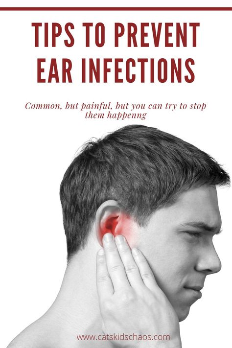 Ear infections can be painful and unpleasant. There are thing you can do to try and prevent them. We have had a fair bit of experience and know that some of these tips really work #earinfections #familyhealth How To Treat Ear Infections At Home, Home Remedy For Ear Ache, Earache Remedies Adults, Ear Ache Remedy For Adults, Ear Infections Remedy For Adults, Ear Infections In Adults, Ear Aches Remedies For Adults, Ear Remedies, Clogged Ears