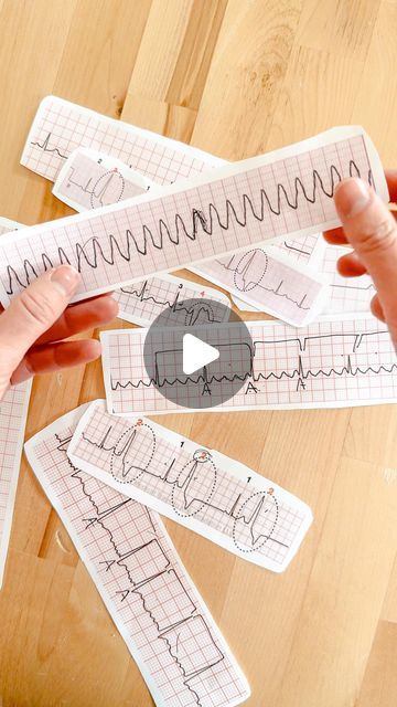 Kristine Tuttle on Instagram: "Get a pulse on your EKG rhythm strip knowledge 🫀😉

Does your program offer a dedicated certification course or week for EKG interpretation?!

#nursingnotes #RN #BSN #nursing #nurseinthemaking #EKG #cardiacnurse" Ekg Interpretation Made Easy, Acls Study Guide, Ekg Rhythms, Bsn Nursing, Nursing Ideas, Nursing Things, Ekg Interpretation, Cardiac Nursing, Heart Rhythms