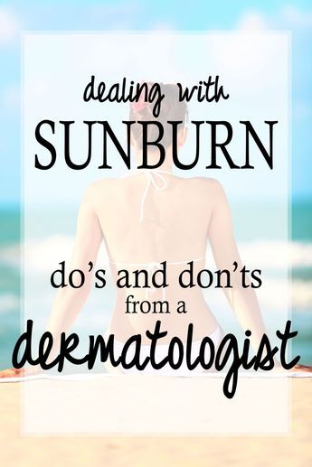 Check out these great tips on how to treat a sunburn, from a dermatologist! Sunburn On Face, Sunburn Face, How To Help Sunburn, Sunburnt Face, Natural Aging Skin Care, How To Treat Sunburn, Antiaging Skincare, Best Face Wash, Anti Aging Tips