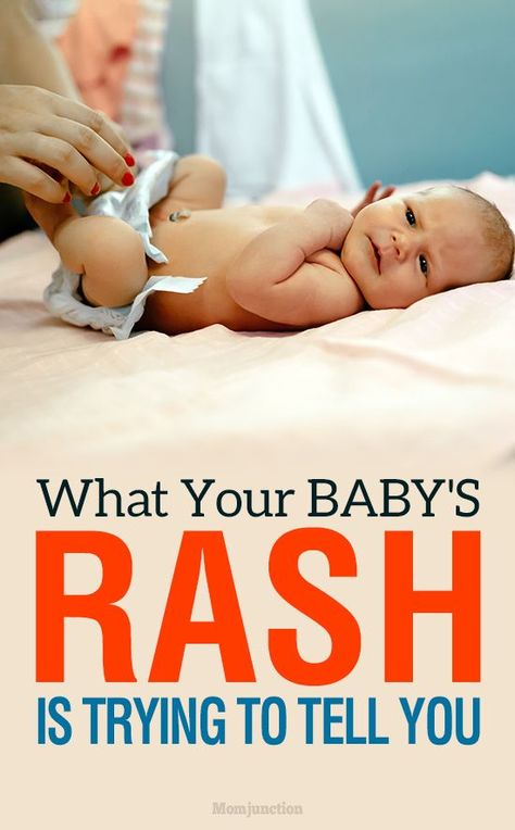 Do You Know What Your BABY'S RASH Is Trying To Tell You? : If your baby has arrived in the world, you might already have a fairly good idea about baby rashes. Despite being a common problem among babies. #newborn #babies #babyhealth  #babyrash #adviceformoms  #parenting #parents Baby Rashes, Pregnancy Info, Baby Help, Pregnancy Information, Pumping Moms, Parenting Done Right, Red Patch, Fantastic Baby, Baby Sleep Problems