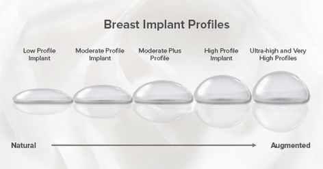 When it comes to breast augmentation there are many different options to choose from. Implants come in different sizes, shapes, and materials. However, the most commonly misunderstood characteristic of breast implants is their "profile." To better understand, read through our latest blog via this link. Mommy Makeover Surgery Recovery, Mommy Makeover Surgery, Increase Breast Size, Breast Implant Illness, Silicone Implants, Makeover Tips, Breast Reconstruction, Money Girl, Celebrity Plastic Surgery