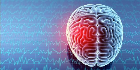 How Does SPECT Differ from Other Brain Scans? | Amen Clinics Symptoms Of Concussion, Sistem Saraf, Brain Injuries, Brain Diseases, Brain Stimulation, Brain Scan, Brain Stem, Brain Damage, Whiplash