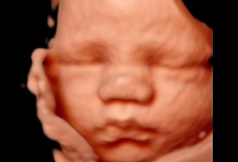 3D/4D Ultrasound Studio! Ultrasound Studio, 3d Ultrasound, 4d Ultrasound, Medical Ultrasound, Baby Ultrasound, Hello Baby, Baby Art, Ultrasound, Birmingham