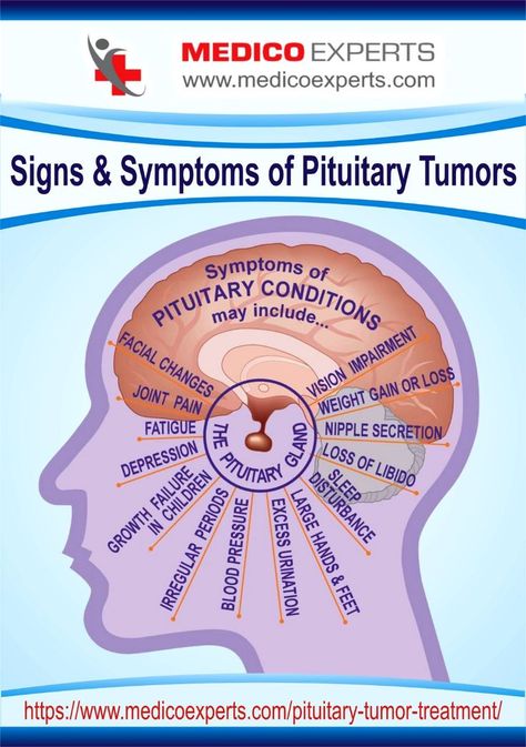 pituitary tumors Pituitary Gland Disorders, Pituitary Gland Tumor, Pituitary Tumor, Quadrants Of The Abdomen, Brain Issues, Ms Symptoms, Pituitary Gland, Brain Surgery, Health Planner