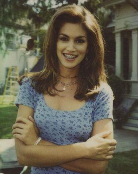 Cindy Crawford is listed (or ranked) 17 on the list 53 Celebrities You Would Never Guess Had Braces Celebrities With Braces, People With Braces, Braces Transformation, Braces Smile, After Braces, Adult Braces, Celebrity Smiles, Braces Girls