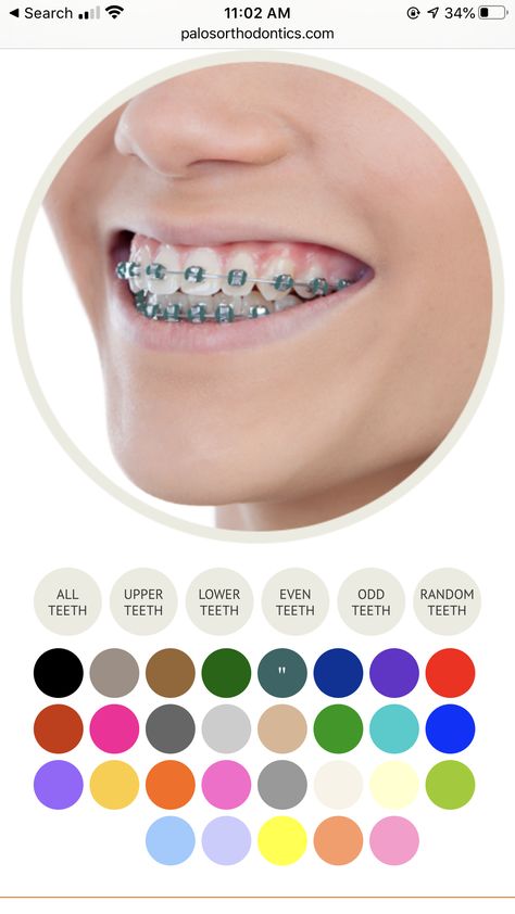 Hot Pink Braces, Braces Colours, Braces Color Wheel, Pink Braces, Green Braces, Braces Colors Ideas, Braces Rubber Bands, Braces Tips, Clear Braces