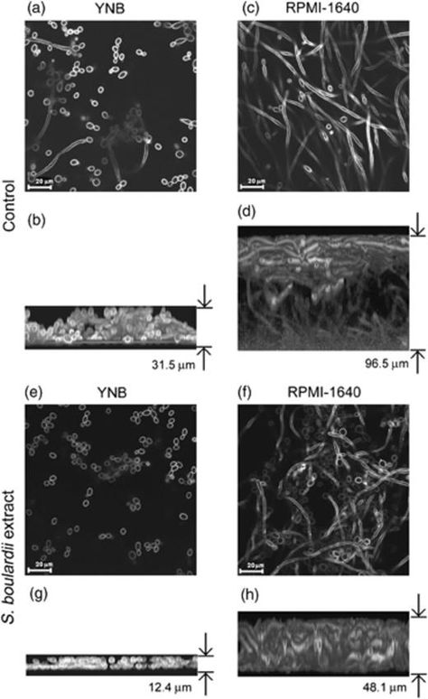 antagonistic effect of Saccharomyces boulardii on Candida albicans filamentation, adhesion and biofilm formation | FEMS Yeast Research | Oxford Academic Saccharomyces Boulardii, Candida Albicans, Active Ingredient, Yeast, Oxford