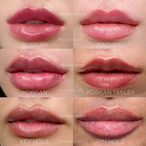 Lip Surgery, Lips Inspiration, Korean Lips, Numbing Cream, Lip Augmentation, Lip Filler, Full Lips, Lip Shapes, Cosmetic Treatments