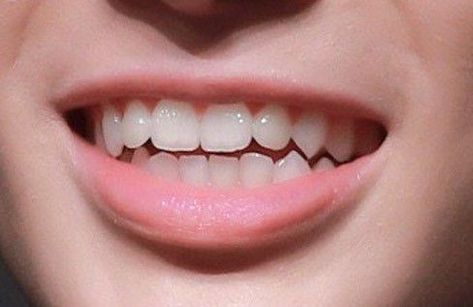 Teeth Claim, Sharp Canine Teeth Human, Natural Fangs Teeth, Cc Face, Txt Details, Teeth With Braces, Fangs Teeth, Teeth Surgery, Teeth Aesthetic