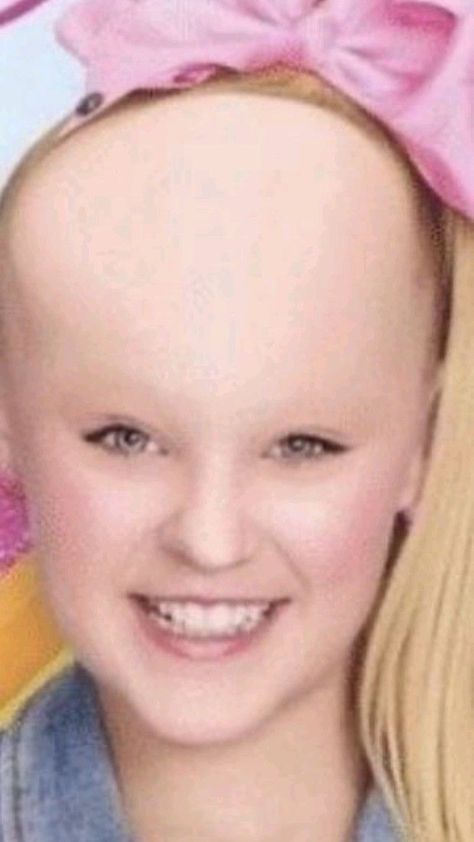 Jojo Siwa Hair, Shrek Funny, Funny Illusions, Cute Funny Pics, Bald Girl, Funny Pix, Funny Frogs, Goofy Pictures, Jojo Memes