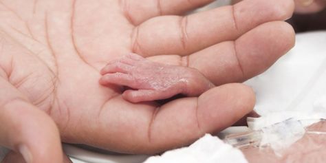 Idaho, Arizona pass sweeping new protections for preborn children | News | LifeSite World Prematurity Day, Preterm Baby, Gestational Age, Premature Birth, Preemies, Premature Baby, Baby Protection, Baby Born, Pregnancy Week By Week