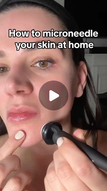 Sarah Fraggis on Instagram: "Micro needling at home with banisher >>  If you have any scarring or pigmentation issues I highly recommended this.   I prefer this tool because it's more accurate than using a roller micro-needling tool.   Get yours at banish.com and use code sarah5 to save $5  Pro tip: red light therapy after micro-needling is ❤️❤️❤️  Xoxo - Sarah #microneedle #banisher #skincare #ledfacemask #howtomicroneedle" Micro Needling Before And After, Microneedling Before And After, At Home Microneedling, Micro Needling At Home, Microneedling At Home, After Microneedling, Skin Needling, Micro Needling, Micro Needle Roller