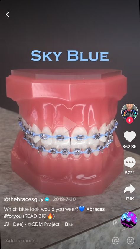 Bracers For Teeth Color, Braces Sky Blue, Sky Blue Braces, Light Blue Braces, Brace Colors, Purple Braces, Power Chain Braces, Braces Colours, Dental Braces Colors