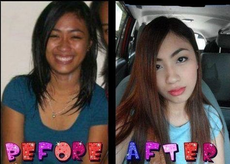 Glutathione Before And After, Manila Fashion, Dry Skin Makeup, Dry Skin Problem, Diy Anti Aging, Scaly Skin, Before And After Pics, Anti Aging Supplements, Anti Aging Products