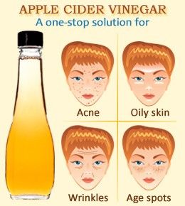 How to Use Apple Cider Vinegar for Acne and Skin Apple Cider Vinegar Face, Face Remedies, Apple Cider Vinegar Uses, Apple Cider Vinegar Remedies, Cider Vinegar Benefits, Apple Cider Vinegar For Skin, Benefits Of Apple Cider Vinegar, Benefits Of Apple Cider, Benefits Of Apple