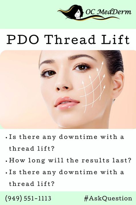 PDO threads are a great way to tighten sagging skin, reduce wrinkling, and create new collagen. A PDO lift can benefit those patients who are suffering from any of the following: Sagging neck, Sagging jowls, Droopy eyebrows, Falling cheekbones. Call us (949) 551-1113 today or Ask Questions at https://irvineskin.com/inquiry-now/ to book your complimentary consultation. Thread Face Lift, Thread Lift Face, Pdo Thread Lift, Sagging Jowls, Pdo Threads, Sagging Neck, Marionette Lines, Thread Lift, Irvine California