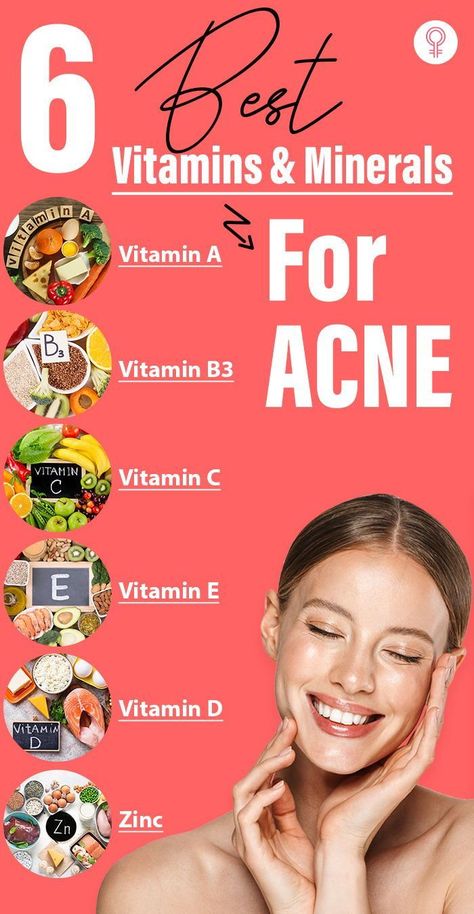 Natural Remedies Mineral Supplements, Acne Beauty, Blind Pimple, Forehead Acne, Pimples Under The Skin, Prevent Pimples, Natural Acne Remedies, How To Get Rid Of Pimples, Reduce Acne