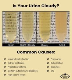 Having cloudy urine is not unusual and, in many cases, it is no reason for alarm. However, it just might be a sign of an underlying health condition. Cloudy Urine Causes, Cloudy Pee, Cloudy Urine, Woman's Health, Bladder Prolapse, Medical Tips, Fitness Healthy Lifestyle, Nursing School Survival, Uric Acid