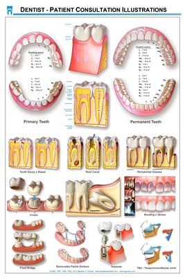 DPCI General Dentistry Dental Wall Chart Poster by Stephen F. Gordon -------&gt;&gt;&gt;&gt;&gt; TO ORDER THIS POSTER and have it SHIPPED to you, click on the "Buy in Print" button below. &gt;&gt;&gt;&gt;&gt; Dental Assistant Study, Dental Posters, General Dentistry, Dental Assistant, Dental Hygiene, Health Care, Wall